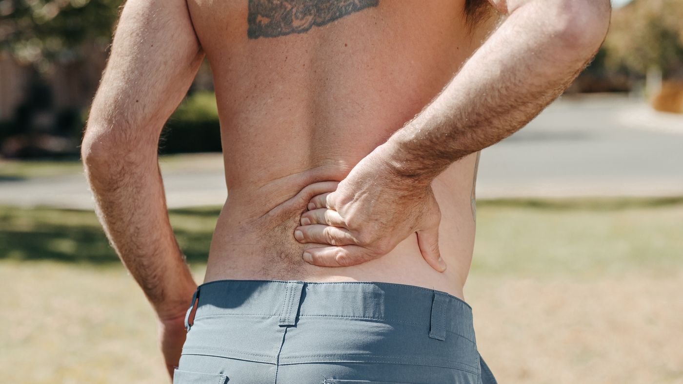 Pilonidal Cyst Los Angeles