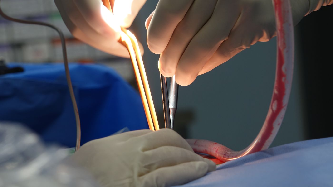Robotic Surgery Los Angeles